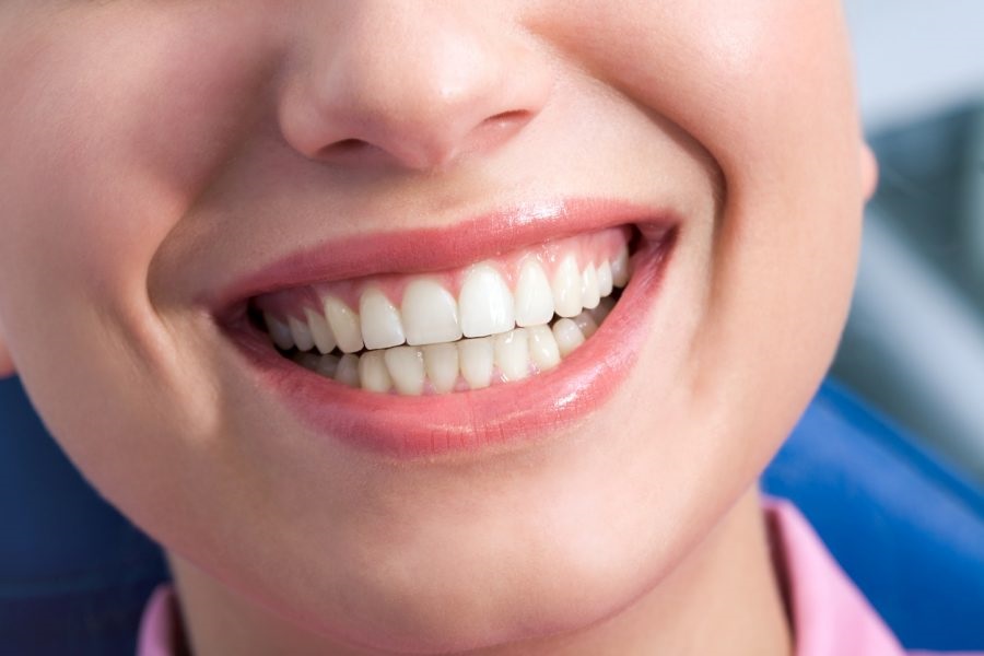 Có nên niềng răng ở bệnh viện răng hàm mặt trung ương TP HCM không?